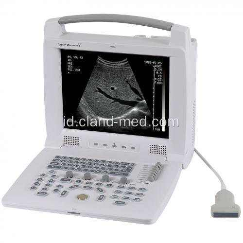 Laptop Portable Ultrasound Scanner Harga Mesin Ultrasound